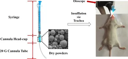 What Is Insufflation?