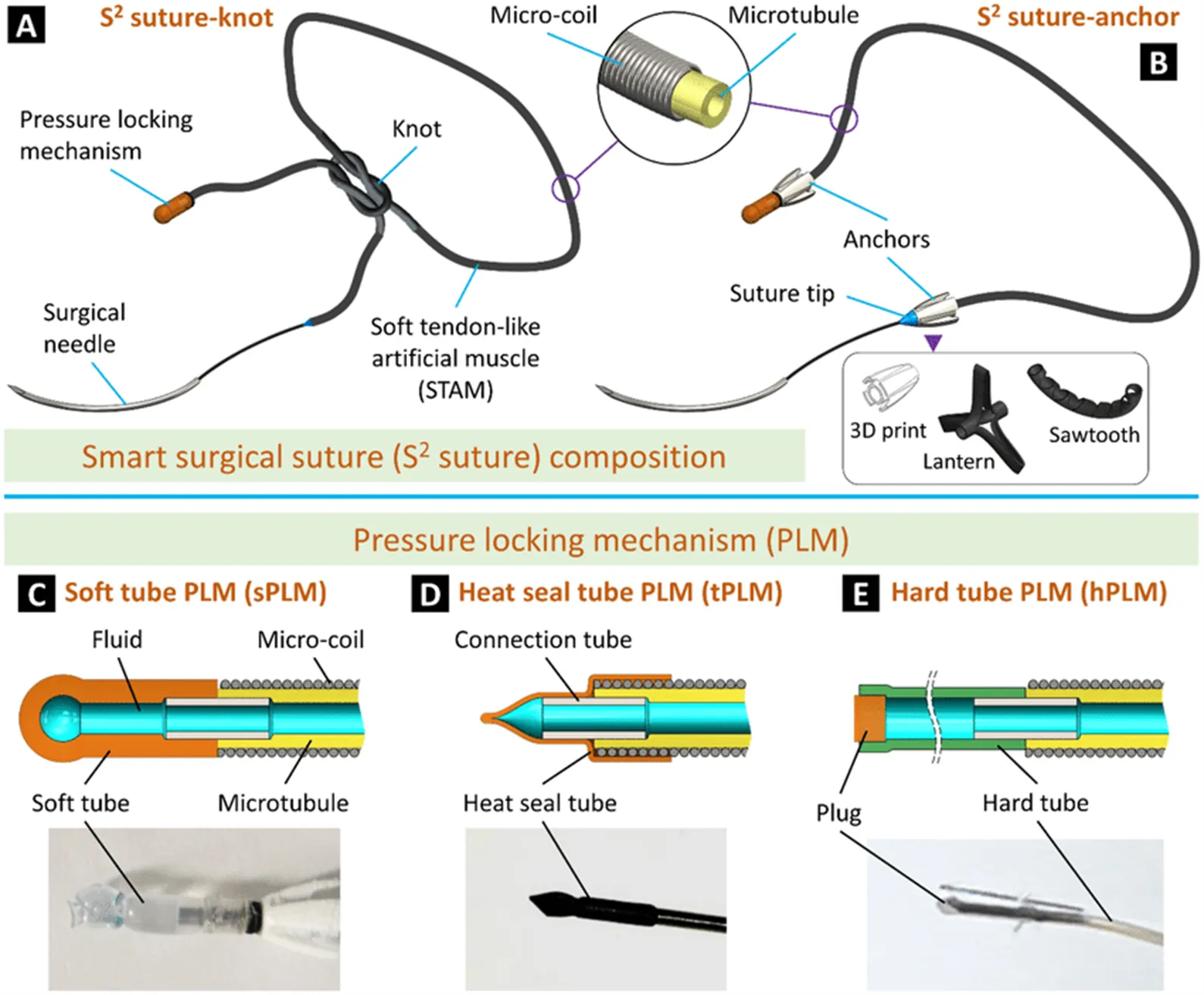 Classification of Suture Materials: Absorbable and Non-Absorbable