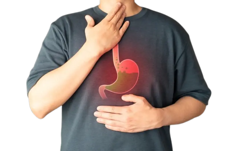 Understanding Hyperacidity: Causes, Symptoms, and How to Manage It