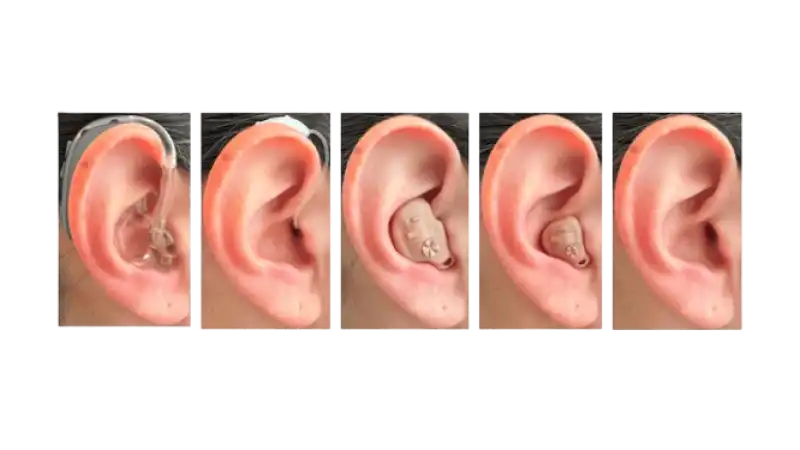 The Ultimate Guide to Hearing Aids: Types, Care, and Adjustment Tips for All Ages