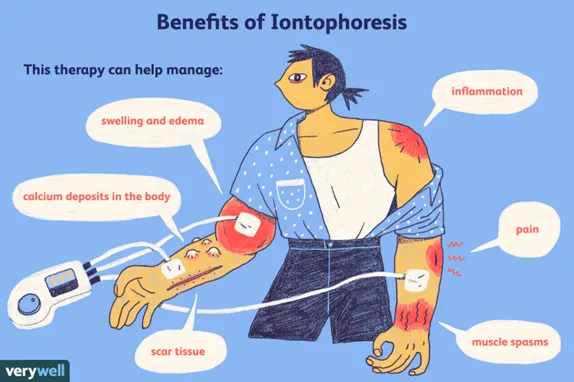 Iontophoresis Machine: Types, Uses, Benefits, and Working Principle