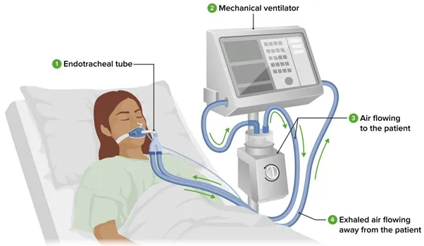 ICU Beds vs Standard Hospital Beds: A Complete, In-Depth Guide for Home Care, Hospitals & Long-Term Recovery in India